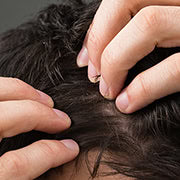 Testosterone Supplements & Hair Loss: An Informative Guide